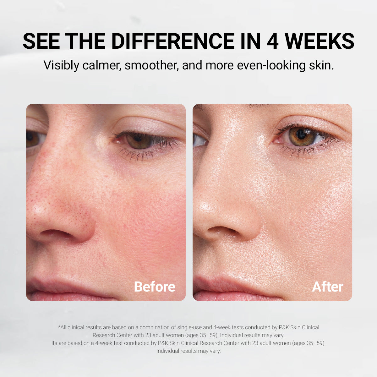 Post Care Balm