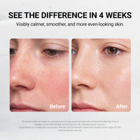 Post Care Balm
