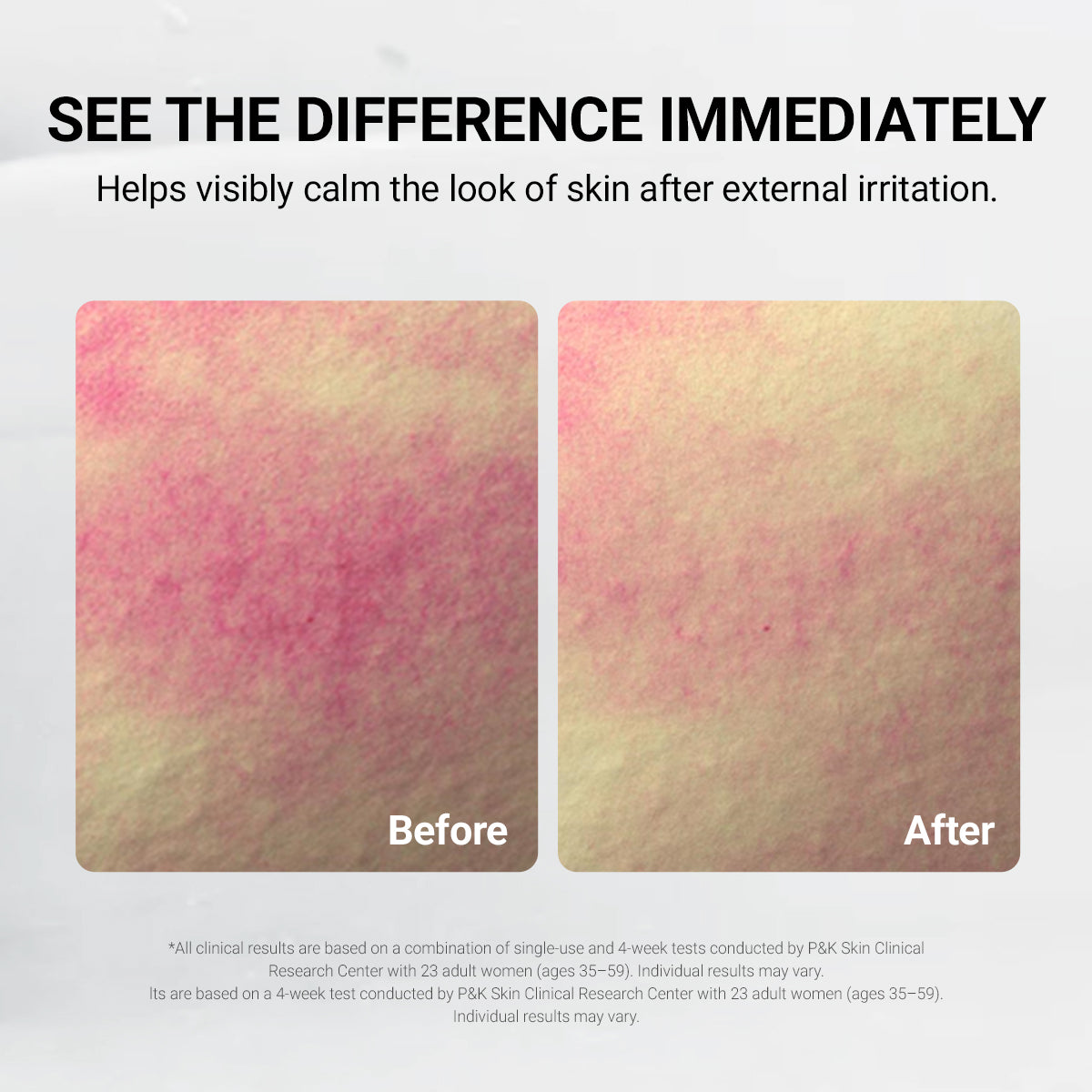 Treatment Cooling Mask