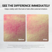 Treatment Cooling Mask